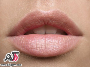مرطوب کننده ویژه لب های خشکی زده و خشک