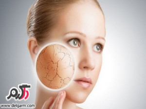 نکات مهم مرتبط با پوست های خشک