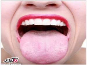 دلیل بزرگ شدن زبان کوچک چیست؟