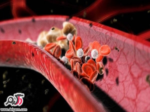 راه های مناسب برای باز شدن عروق قلبی