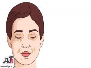علت تورم صورت چیست؟