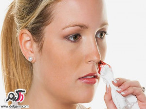 علت خون دماغ شدن چیست؟