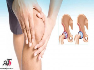 آتروفی عضلانی چیست؟آیا آتروفی درمانی هم دارد؟