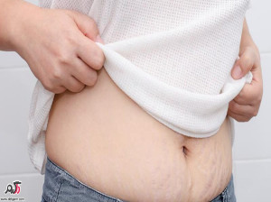 علت خارش اطراف ناف چیست؟