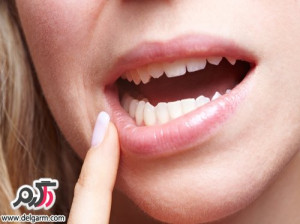 آنتی بیوتیک مناسب برای عفونت دندان