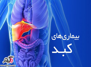 علل هپاتومگالی(بزرگی کبدی) چیست؟چگونه درمان میشود؟