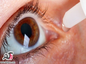 علت و درمان بیماریهای "ماکولا" (دژنراسیون ماکولا)