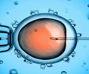 مزایای IVM نسبت به IVF برای درمان ناباروری