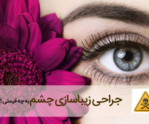 عوارض انواع عمل زیبایی چشم + ویدیو جراحی