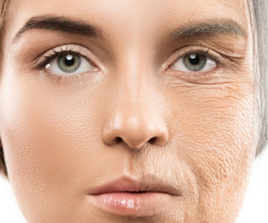 کلاژن چیست ؟ کاربرد و راههای افزایش کلاژن در بدن