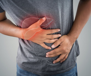 همانژیوم کبدی چیست؛ آیا همانژیوم کبدی کشنده است ؟