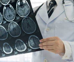 تفاوت جراح مغز و اعصاب و نورولوژیست چیه؟