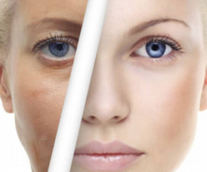 مزو ژل چیست و چه کاربردی دارد؟