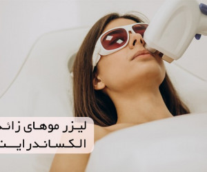 لیزر موهای زائد در کرج