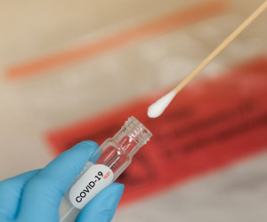 فرق تست PCR با تست آنتی بادی کرونا چیست ؟
