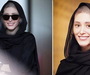 عکس کچل فرشته حسینی