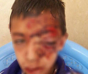 سقوط وحشتناک یک دانش آموز از کوه بخاطر اینترنت و شبکه شاد ؟!