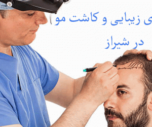 لیست کلینیک های زیبایی و کاشت مو در شیراز همراه با آدرس و تلفن