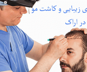 لیست کلینیک های زیبایی و کاشت مو در اراک به همراه آدرس و تلفن