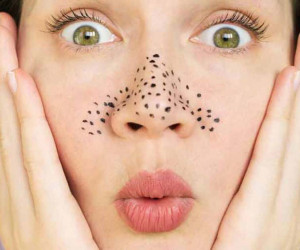 8 راهکار فوق العاده برای جلوگیری از ایجاد جوش های سر سیاه