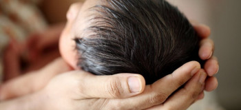 آیا ریزش پوست سر نوزاد طبیعی است؟