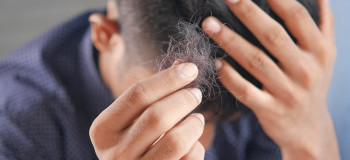 آلوپسی | بهترین و سریع ترین راه بهبود و درمان آلوپسی آره آتا (طاسی یا ریزش مو)
