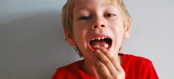 چند دلیل دیر افتادن دندان‌ شیری کودکان