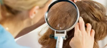 کلاه ضد شپش چگونه به از بین بردن شپش سر کمک می کند؟