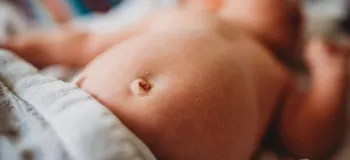 ناف نوزاد را چگونه تمیز کنیم ؟