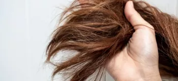 روغن تراپی مو : برای درمان موخوره کدام روغن مناسب است ؟