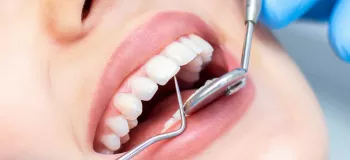 مراجعه زن به دندانپزشک مرد در اسلام چه حکمی دارد؟