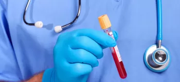 آزمایش خونی که تاریخ مرگ شما را اعلام می کند !