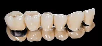 آیا روکش دندان قابل ترمیم است ؟