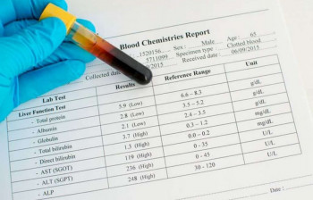SGPT (تست ALT) در آزمایش خون + بررسی خطرات این آزمایش