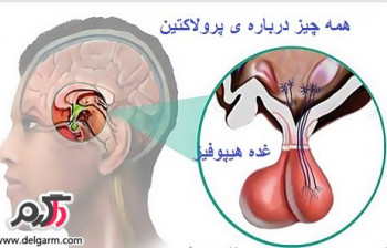 آزمایش پرولاکتین برای چی انجام میشه؟