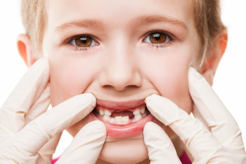 شیری ها و عصب کشی: آیا دندان شیری عصب دارد؟