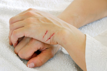 مراقبت از زخم – درمان، عفونت و عوارض
