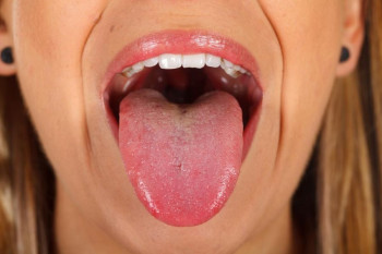 علائم اولیه سرطان دهان را جدی بگیرید! 