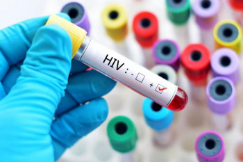 علائم ایدز بعد از روابط جنسی پر خطر و پاسخ به سوالات کاربران 
