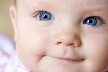  چه چیزی باعث ایجاد انحراف چشم در نوزادان میشود؟ 