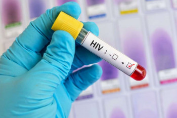 درمان ایدز: ۹ روش خانگی شگفت انگیز برای درمان ایدز
