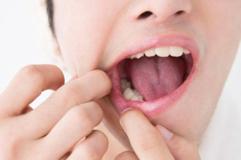 عفونت دندان و روشهای درمان آن
