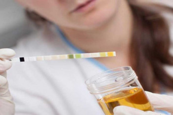 علت بالا و پایین بودن Micro Albumin در آزمایش ادرار