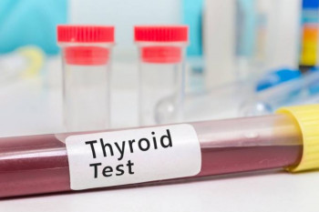 علت بالا و پایین بودن TSH در آزمایش خون