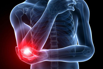 علل و علائم آرنج تنیس بازان یا بیماری تنیس البو چیست ؟