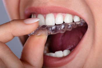 زیبا سازی دندان با ارتودنسی نامرئی