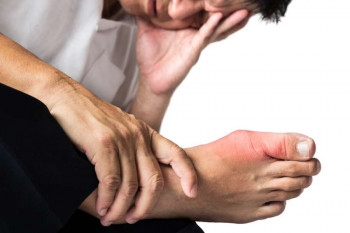علائم نقرس پا چیست و چگونه درمان میشود ؟