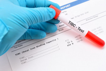 معنای tibc در آزمایش خون چیست + علائم و درمان نوسان این آزمایش