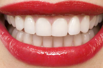 معرفی کامل اسامی دندان ها از ۱ تا ۳۲ همراه با تصویر