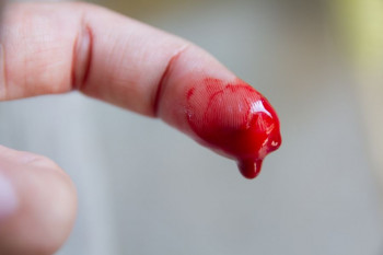 هنگام خونریزی یا قطع عضوی از بدن چه باید کرد ؟